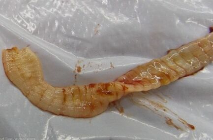 Parasites in the body